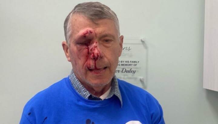 Mark Crosby suffered multiple facial fractures and temporary blindness. Photo: LifeNews.com